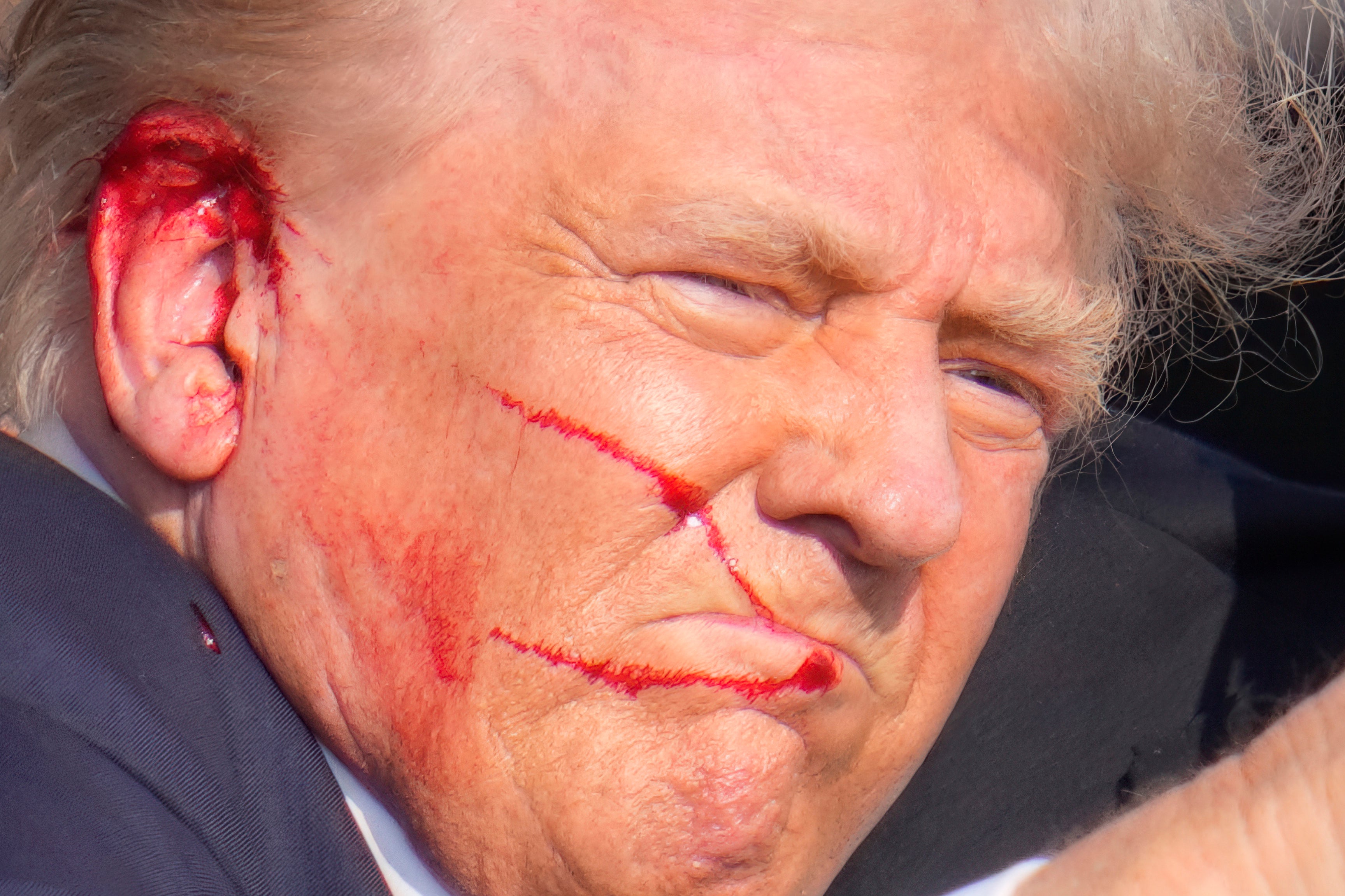 Donald Trump said ‘much bleeding took place’ after a bullet pierced his right ear (Gene J Puskar/AP)