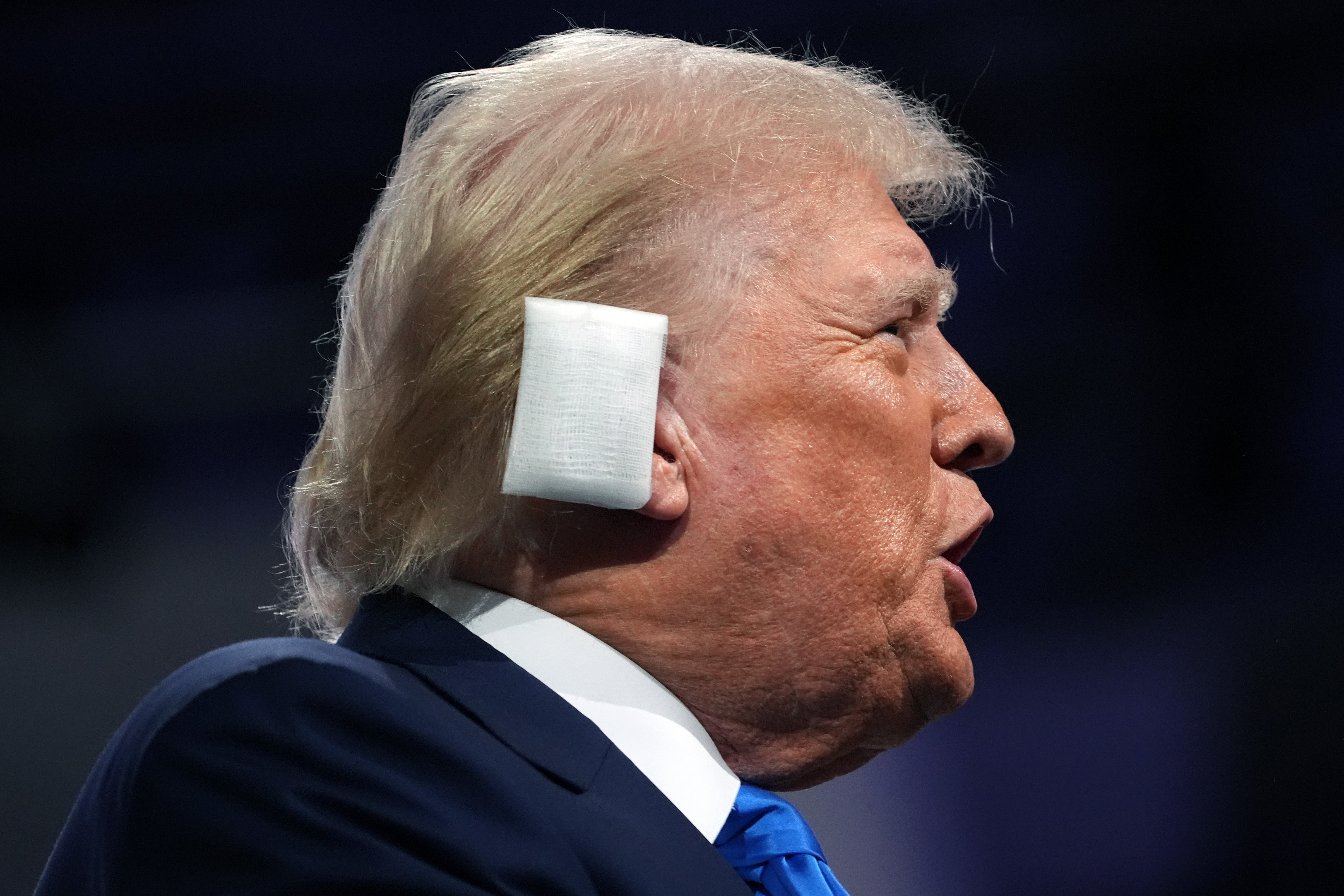 Republican presidential candidate, former U.S. President Donald Trump arrives on the second day of the Republican National Convention at the Fiserv Forum on July 16, 2024 in Milwaukee, Wisconsin. Ronny Jackson, a Texas congressman and former White House physician, designed the bandage